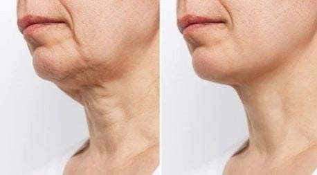 Products for a younger looking Neck &amp; Chest